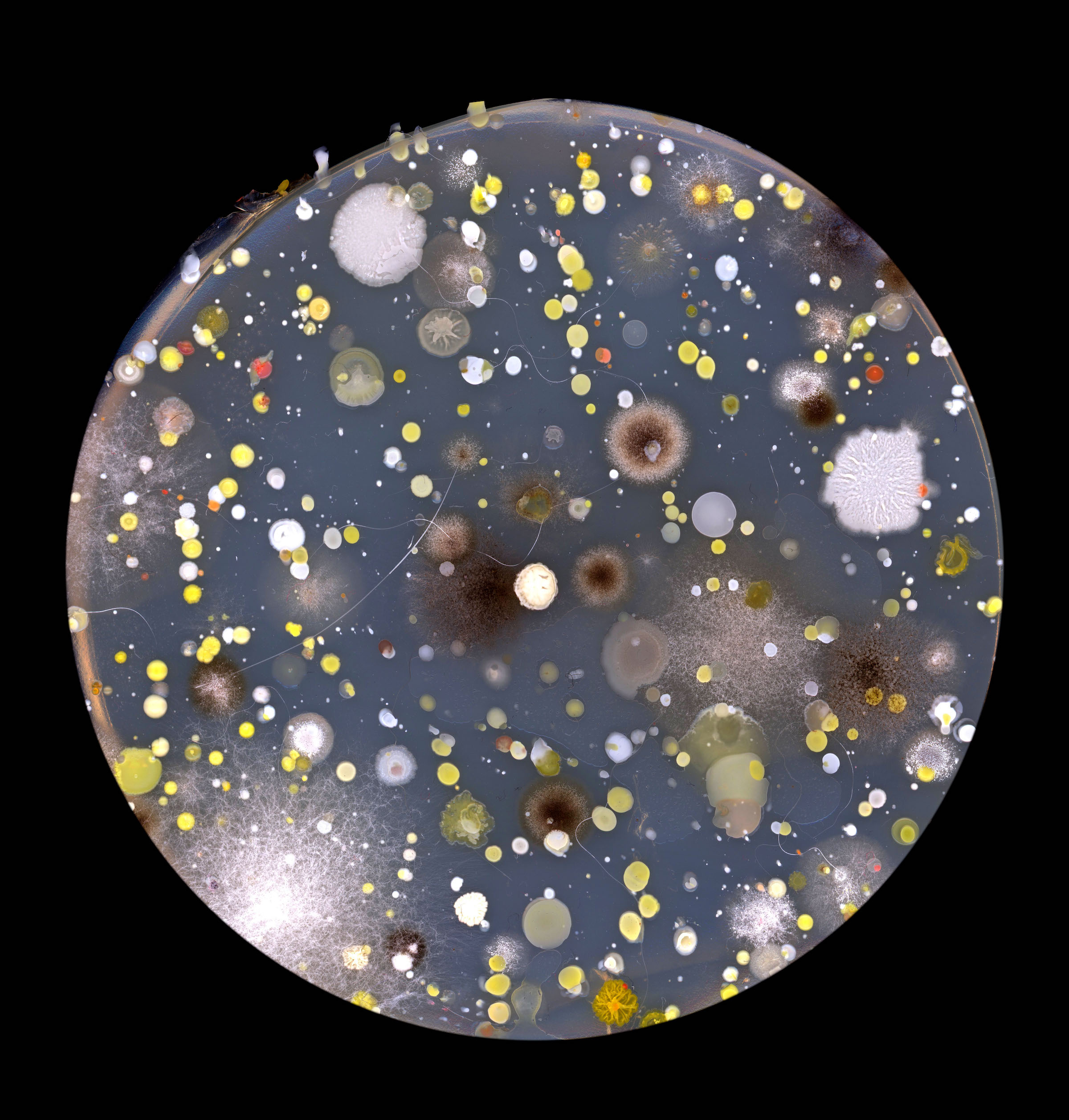 petri dish of bacteria clusters