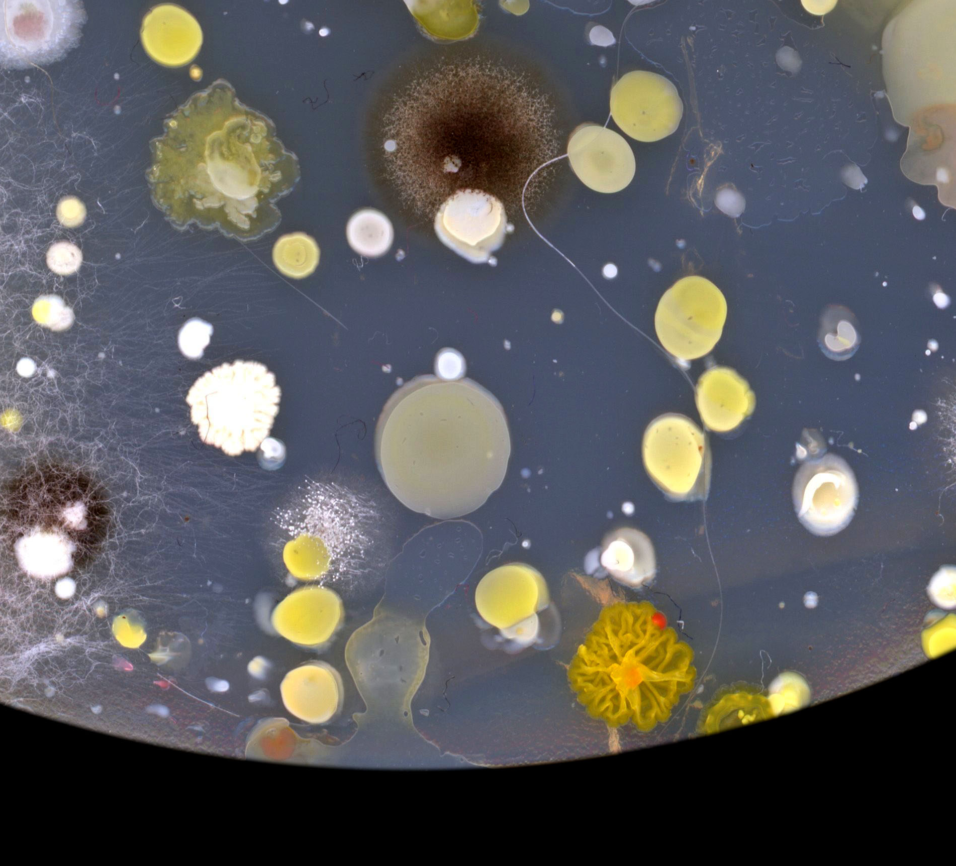 closeup of bacterial colonies in a petri dish